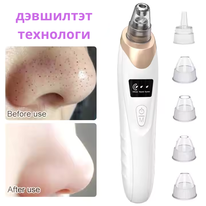 DermaSuction Батга цэвэрлэгч төхөөрөмж