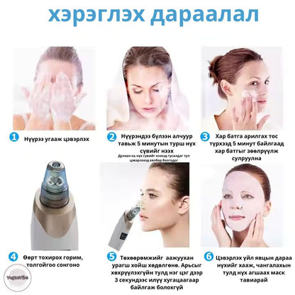 DermaSuction Батга цэвэрлэгч төхөөрөмж